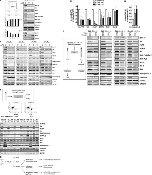 Figure 1. Blood leukemia cell isolation methods have an impact on intracellular protein integrity. All studies were performed using fresh primary lymphocytes isolated from blood obtained from patients with CLL. Patients gave informed consent to participate in this laboratory protocol, which was approved by the Institutional Review Board of The University of Texas MD Anderson Cancer Center. Informed consent was provided according to the Declaration of Helsinki. (A) Immediate processing of whole blood on-site at the clinical trial location. Blood from the same patient (n = 5) was collected directly into a Vacutainer GTT (#366480; Becton Dickinson, Franklin Lakes, NJ) and a CPT (#362753; Becton Dickinson) simultaneously. Each tube contained sodium heparin and was kept at ambient temperature until processing. Briefly, for the GTT processing using Ficoll, the blood was mixed with 2 volumes of phosphate-buffered saline (PBS) and then overlaid gently onto 10 mL of Ficoll-Hypaque and centrifuged for 20 minutes at 20°C. The PBMCs were isolated, washed twice with PBS, and counted. The cell number was determined by using a Coulter Channelyzer (Coulter Electronics, Hialeah, FL). The CPT was centrifuged at 1800g for 20 minutes at ambient temperature, and then the tube was inverted several times to recover the isolated cells above the polyester gel barrier per the manufacturer’s recommendation. Isolated cells were washed twice with cold PBS and counted. For measurement of apoptosis levels, CLL cells (n = 5) isolated by Ficoll (white bars) or CPT (black bars) were incubated with annexin V, fluorescein isothiocyanate (FITC), and propidium iodide and were analyzed by flow cytometry. Similarly, to measure percentages of erythrocytes and B cells, CLL cells were stained with CD19-phycoerythrin (PE) and CD235A-FITC and analyzed by flow cytometry. Immunoblot analysis was performed as previously described5 by using the following antibodies: Akt (BD Pharmingen); Bak (Millipore); Bcl-2 (Dako, Carpinteria, CA); Btk (Abcam, Cambridge, MA); hemoglobin β, β-actin, and β-tubulin (Sigma); glyceraldehyde-3-phosphate dehydrogenase (GAPDH; Novus Biologicals, Littleton, CO); Mcl-1 and STAT5 (Santa Cruz Biotechnology, Santa Cruz, CA); PARP (Enzo Life Sciences International, Plymouth Meeting, PA); total RNA Pol2 (8WG16) and phospho-RNA Pol2 (Ser2) (Covance, Emeryville, CA); and ZAP-70 (Cell Signaling Technologies, Beverly, MA). Immunoblot analysis of cellular proteins of PBMCs isolated from blood collected in GTT (lane GT) or CPT (lane CP) from patient #1 is shown. Protein levels were quantified relative to GAPDH, then normalized to protein levels in Ficoll-isolated PBMCs from GTT-collected blood (lane GT). (B) Immunoblot analysis of cellular proteins of PBMCs isolated from blood collected in GTTs (lane GT) or CPTs (lane CP) from patients #2 to #5. (C-D) Quantified cellular protein levels in GTT- and CPT-isolated cells. Immunoblots shown in Figure 1A-B were analyzed by using Li-Cor Odyssey software (Li-Cor Inc., Lincoln, NE), and protein levels were normalized to GAPDH loading control. Protein levels in CPT-isolated cells (lanes CP) were expressed relative to levels in GTT-isolated cells (lane GT), and asterisks denote statistical significance (*P < .05) as determined by using GraphPad Prism software (GraphPad Software, Inc. San Diego, CA). (E) Simulation of blood drawn into a GTT or CPT and then shipped overnight to an off-site reference laboratory. Blood was collected as described in (A), the CPT was processed by centrifugation, and the PBMCs were kept in the CPT at 4°C for 20 hours to simulate overnight transport on icepacks. The GTT was kept at 4°C for 20 hours, and then the PBMCs were isolated using the Ficoll method. Immunoblot analysis of cellular proteins of PBMCs isolated from blood collected in GTTs (lane GT) or CPTs (lane CP) from patients #1, #2, #4, and #5 are shown. (F) Isolation of primary leukemia cells drawn into GTTs and then shipped overnight to an off-site reference laboratory. Blood from patients with CLL (n = 6) was collected into GTTs and kept at 4°C for 20 hours to simulate shipment on wet ice to a reference laboratory. Half the sample was then processed using Ficoll and half was transferred into a CPT containing sodium heparin and centrifuged. Shown is the flow cytometry analysis of CLL cells from patient #11 isolated by Ficoll (left) or CPT (right) and stained with CD235A-FITC/CD19-PE. Immunoblot analysis of CLL primary cells from patients #6 to #11 isolated by Ficoll (lane F) or CPT (lane CP) is shown. (G) Implications and consequences of cellular protein loss on CLL biology, diagnostics, and therapeutic research.