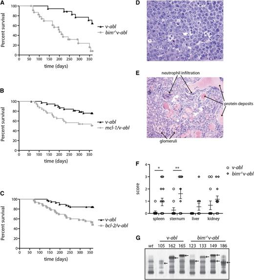 Figure 2. Inhibition of apoptosis accelerates plasmacytomagenesis. Kaplan-Meier survival curves in cohorts of (A) bim−/−v-abl (n = 24; P < .0001); (B) mcl-1/v-abl (n = 39; P = .013); and (C) bcl-2/v-abl (n = 47; P = 0.0002) mice and their v-abl littermates (n = 18, 39, and 57, respectively). (D-F) Histological analysis of moribund mice. H&E-stained sections from (D) a mesenteric lymph node tumor showing cells of classic plasmacytoma morphology (400× magnification) and (E) the kidney of a plasmacytoma-bearing mouse, showing the typical myeloma kidney characteristics, namely protein deposits and neutrophil infiltration in the tubules (200× magnification, photographed using a compound microscope; Axioplan 2; Zeiss). (F) H&E-stained sections of the organs from moribund v-abl (n = 10) and bim−/−v-abl (n = 12) mice were scored blind for the degree of disease infiltration on a scale of 0 to 3 (with 3 being 100% of the organ affected). Mean ± SEM, *P < .05, **P < .01, Student t test. (G) Analysis of plasmacytoma clonality by serum gel electrophoresis. In most cases a single paraprotein (arrowed) is apparent (compare with serum from WT); however, bim−/−v-abl #149 is biclonal.