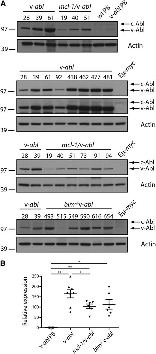 Figure 3. v-abl transgene is highly expressed in plasmacytomas. (A) Western blot analysis of v-abl protein expression in plasmacytomas (whole tissue) from v-abl, mcl-1/v-abl, and bim−/− v-abl mice and PBs generated in vitro by LPS stimulation of B cells from WT and v-abl mice (Materials and methods) (note: the in vitro generated PB from v-abl mice contained very few v-abl expressing cells; data not shown). Two exposures are shown for the v-abl plasmacytomas to demonstrate that c-Abl can only be seen when v-Abl is overexposed. This is in contrast to Figure 1B, where levels of v-Abl and c-Abl were comparable and suggests that v-Abl expression is high in the plasmacytomas due to expression in all cells and upregulation. MW markers are indicated (kDa). (B) Real-time PCR analysis of v-abl mRNA in plasmacytoma cells from individual v-abl, mcl-1/v-abl, and bim−/− v-abl mice and PB generated in vitro from v-abl mice (see above). Expression was normalized to HMBS, and the data are expressed relative to PBs. Mean ± SEM, n = 6 to 8 independent tumors. *P < .05, **P < .01, Student t test.