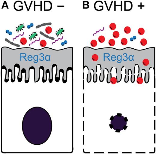 Hypothetical model of the relationship between intestinal bacterial diversity and GVHD. (A) When bacterial diversity is high, antimicrobial peptides such as Reg3α can protect intestinal epithelial cells from damage and GVHD is averted. (B) When bacterial diversity is low, Reg3α is insufficient to counter the overwhelming number of bacteria resulting in intestinal epithelial cell apoptosis and GVHD.