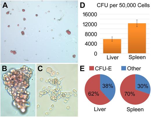 Figure 1. HPC activity from axolotl spleen and liver. (A) Representative view (×10) of spleen CFU at 10 days. (B) Magnification (×40) of a large CFU-E colony. (C) Magnification (×40) of a non-CFU-E colony. (D) Quantitation of CFUs in the liver and spleen reveals that the spleen contains more than twice as many CFUs as the liver (12 253 vs 5825, P = .0009; N = 3). Graphs show mean ± standard error of the mean of ≥3 independent experiments. (E) The proportion of CFU-E to other CFU colonies (P = .4). CFU assays were imaged on a Leica DMIRB inverted microscope using a SPOT Flex digital camera.