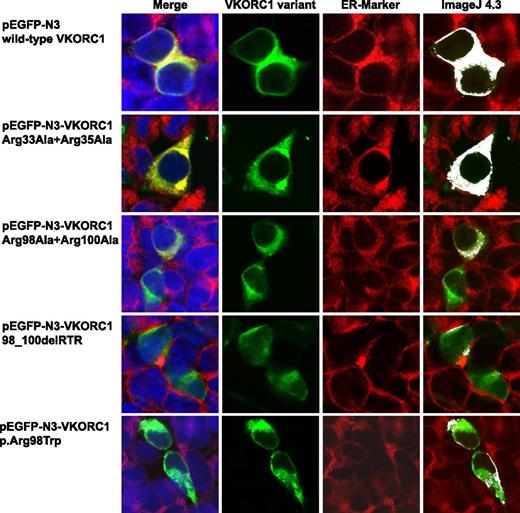 Figure 2. Colocalization images for wt hVKORC1 and mutated di-arginine motif variants in HEK293T cells. This figure shows representative colocalization images of single immunostained HEK293T cells expressing wt hVKORC1, Arg33Ala + Arg35Ala, Arg98Ala + Arg100Ala, the 98_100delRTR variant, and the human p.Arg98Trp mutant variant, respectively. Each panel is composed of 4 images; the first one is a merged picture of the green-colored EGPF-tagged hVKORC1 protein, the red-stained ER (primary antibody: anti-PDI; secondary antibody: AlexaFluor 594), and the blue-counterstained nucleus by ToPro3. Colocalization is represented with increasing intensity of yellow in the first image. The second image shows cells expressing the EGFP-tagged hVKORC1 protein in green only, followed by the third image in which the ER is red stained. The last column shows colocalized regions as white dots using the colocalization highlighter plug-in embedded in ImageJ 4.3. All images were rendered using ImageJ version 4.3. The images clearly show a high ER colocalization for wt hVKORC1 and the Arg33Ala + Arg35Ala variant. All other variants affecting the Arg98_Arg100 di-arginine motif show a drastic decrease in ER colocalization.