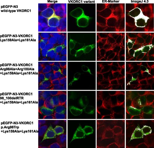 Figure 5. Colocalization images for mutated di-lysine variants in combination with mutated di-arginine motif variants in HEK293T cells. This figure shows representative colocalization images of single immunostained HEK293T cells expressing the Lys159Ala + Lys161Ala, Lys159Ala + Lys161Ala + Arg98Ala + Arg100Ala, Lys159Ala + Lys161Ala + 98_100delRTR, and the Lys159Ala + Lys161Ala + p.Arg98Trp mutant hVKORC1 variants, respectively. Each panel is composed of 4 images; the first one is a merged picture of the green-colored hVKORC1 variant (EGFP tagged), the red-stained ER (primary antibody: anti-PDI; secondary antibody: AlexaFluor 594), and the nucleus counterstained with ToPro3 (blue). Colocalization is represented with increasing intensity of yellow. The second image shows cells expressing the EGFP-tagged VKORC1 protein only, followed by the third image showing the red-stained ER. The last column shows colocalized regions as white dots using the colocalization highlighter plug-in embedded in ImageJ 4.3. All images were rendered using ImageJ version 4.3. The di-lysine–mutated hVKORC1 variant Lys159Ala + Lys161Ala shows a higher amount of ER retention than the di-arginine variants shown in Figure 2. Also, in combination with the di-arginine variants the di-lysine variants do not show a more drastic decrease in ER retention.