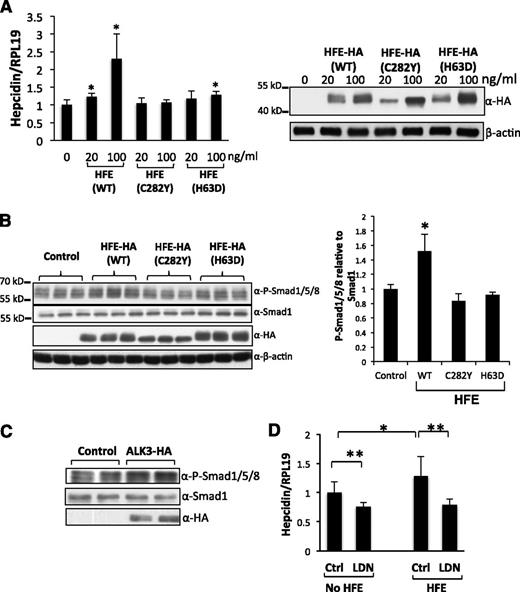 Figure 1. HFE increases hepcidin expression through the BMP pathway. (A) Hep3B cells were transfected with WT, HFE-C282Y, or HFE-H63D at 0, 20, and 100 ng/mL. Forty-eight hours after transfection, cells were harvested for real-time PCR analysis for hepcidin mRNA levels, and for western blotting for HFE protein levels. (B) Hep3B cells were transfected with WT, HFE (C282Y), or HFE (H63D) at 100 ng/mL. Cells were harvested for western blotting for phospho-Smad1/5/8, Smad1, and HFE expression (right panel). Phospho-Smad1/5/8 levels obtained by western blot analysis were quantified and normalized to the signal obtained for Smad1 (left panel). (C) Hep3B cells were transfected with empty vector (control) or ALK3-HA expression plasmid. Cells were harvested for western blot analysis for phospho-Smad1/5/8, Smad1, and ALK3 protein expression. (D) Hep3B cells were transfected with or without HFE-Myc (100 ng/mL). Forty-two hours after transfection, cells were treated with or without LDN-193189 (20 nM) for 6 hours. Cells were then collected for real-time PCR analysis for hepcidin and RPL19 mRNA levels. Data represent averages of the values from 3 separate experiments. RPL19 is the internal control. β-actin is the loading control in western blotting. *P < .05, **P < .01 vs the control (bar 1). Data are represented as mean ± SD (n = 3).