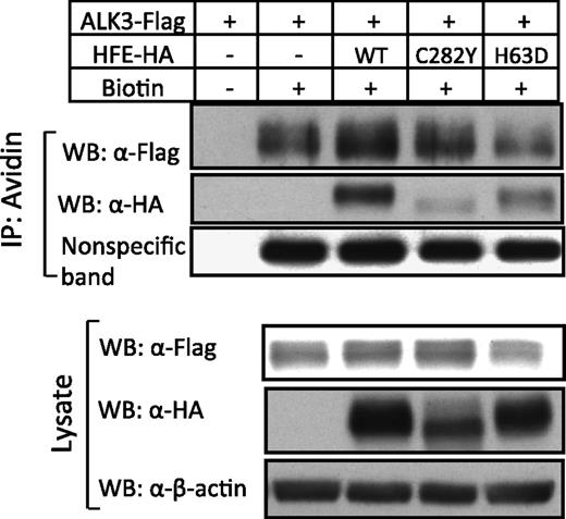 Figure 5. HFE, but not HFE-C282Y and HFE-H63D, increases ALK3 cell-surface expression. Hep3B cells were transfected with ALK3-Flag in the presence or absence of HFE-HA (WT), HFE-HA (C282Y), and HFE-HA (H63D). Forty-eight hours after transfection, whole cells were incubated with and without Sulfo-NHS-LC-LC-Biotin, and the cell lysates were precipitated with Streptavidin Agarose. The whole-cell lysates and avidin precipitates were subjected to western blot analysis with antibodies as indicated. A nonspecific membrane protein was used as loading control. The experiment was repeated 3 times.