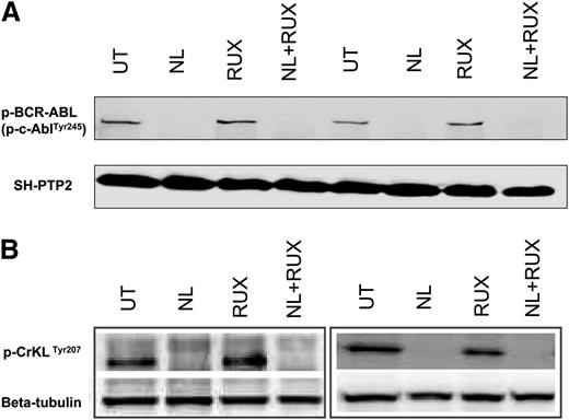 Figure 2. Effects of the NL and RUX combination on BCR-ABL kinase activity. CML CD34+ cells were either left UT, or treated for 8 hours with NL (5 µM) or RUX (1000 nM) or their combination, prior to protein extraction and measurement of (A) p-BCR-ABL (p-c-AblTyr245) (n = 2), and (B) p-CrkLTyr207 (n = 4, 2 representative blots shown) levels by western blot. SH-PTP2 (A) and β-tubulin (B) were used as loading controls.