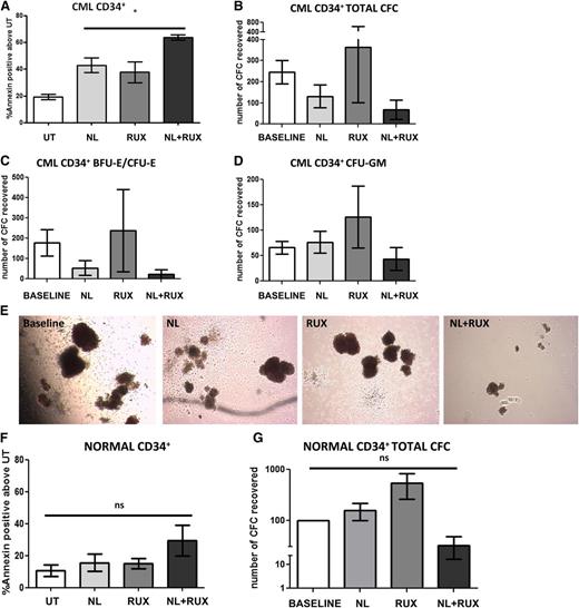 Figure 3. Effects of the NL and RUX combination on CML and normal CD34+ cell viability and CFC output. (A) CML CD34+ cells (n = 3) were either left UT, or treated with NL (5 µM) or RUX (200 nM) or their combination, and cultured. At 48 hours, apoptosis levels were measured by Annexin-V/7AAD staining. CML CD34+ cells (n = 3) were cultured as in (A) for 72 hours before drug washout and plating in methylcellulose progenitor assays. (B) Total CFC output was recorded after 12 days culture and compared with the CFC output for each sample prior to the start of the culture (baseline) (note that the number of colonies following 72 hours culture was adjusted for the expansion of CD34+ cells in vitro in each arm relative to baseline). (C) CFC frequency based on their morphology (erythroid-burst forming unit and erythroid-colony forming unit), and (D) granulocyte/macrophage-colony forming unit was also recorded and again compared with baseline. (E) Representative pictures of the size and morphology of recovered CFC in each treatment arm. Normal CD34+ cells (n = 3) were either left UT, or treated with NL (5 µM) or RUX (200 nM) or their combination. (F) At 48 hours, apoptosis levels were measured by Annexin-V/7AAD staining. Normal CD34+ cells (n = 3) were cultured as in (A) for 72 hours before drug washout and plating in methylcellulose progenitor assays. (G) Total CFC output was recorded after 12 days culture and compared with the CFC output at baseline as explained in (B). All data from independent experiments are presented as mean ± SEM. Significance values: *P < .05; †P < .01; ‡P < .001.