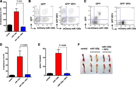 Figure 4. Rescued expression of IRF4 inhibits miR-125b–induced myeloid leukemia. (A) IRF4 inhibits miR-125b–induced hyperproliferation in vitro. Control cells correspond to MG-infected BMCs. BMCs were transduced with retroviruses that encode miR-125b and HcRed. These cells were then transduced with MG or MIG-IRF4 retroviruses, which coexpresses GFP and IRF4. HcRed+GFP+ cells were sorted, and 20K cells per mL of cells were plated. The cell number was determined 3 days later. Representative of 3 experiments. (B) BMCs were transduced with retroviruses that encode miR-125b and mCherry. These cells were then infected with MG or MIG-IRF4 viruses. Shown are flow cytometric plots of these cells and infection efficiency before transplantation into mice. Plots show cells overexpressing miR-125b in the x-axis (mCherry+) and either GFP+ or GFP+ IRF4-overexpressing cells in the y-axis. (C) BMCs described in panel B were transplanted into recipient C57bl/6 mice. One month after transplantation, the peripheral blood of the recipient mice was analyzed by flow cytometry. The left and right panels represent the blood of recipient mice transplanted with BMCs coinfected with miR125b-mCherry with GFP vector and miR125b-mCherry with IRF4-GFP vector, respectively. Representative of 4 mice. (D) Recipient mice were transplanted with donor BMCs that overexpress miR-125b alone or along with restored IRF4 expression mice. The peripheral blood of the recipient mice (>6 mice per group) was analyzed by flow cytometry. Plot displays the Cd11b+ myeloid cell count 3 months after transplantation of donor cells. Control mice represent normal healthy C57bl/6 mice. P value obtained through Mann-Whitney t test. (E) The percent splenic Cd11b+ myeloid was determined using flow cytometry ∼3 months after cell transplantation. (F) Representative images of the femur and tibia of the corresponding recipient mice are shown.