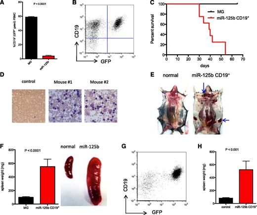 Figure 5. MiR-125b induces tumorigenesis in pre-B cells. (A) MG and MG-125b were bled 12 weeks after bone marrow reconstitution. The figure represents the percent of B cells (CD19+) within the GFP+ gated population in the peripheral blood of these mice (at least 3 mice per group). P value was calculated by Student t test. (B) GFP+CD19+ B cells were sorted from MG-125b mice 4 to 6 months after bone marrow reconstitution. CD19+ B cells (35-52K) were transplanted into sublethally irradiated mice. The figure shows the flow cytometric analysis of the secondary recipient mice (bone marrow) 6 weeks after transplantation. Representative of 8 mice. (C) The figure shows the survival of curve of the secondary recipient mice transplanted with GFP+CD19+ cells from MG-125b mice (8 mice) or total BMCs from MG mice (6 mice). (D) Wright stain was performed from the blood of recipient mice injected with miR-125b–overexpressing CD19+ cells. The dark purple cells represent leukocytes. The smaller cells with central pallor are red blood cells. (E) Some recipients of miR-125b–overexpressing CD19+ cells develop lymphomas. Lymphomas shown at the superficial cervical (top blue arrow) and inguinal lymph node sites (side blue arrow). The normal mouse shown is a healthy C57bl/6 mouse. (F) Left panel, The spleen weight of the recipient mice transplanted with GFP+CD19+ cells (denoted as “miR-125b CD19+”) from MG-125b mice or total BMCs from MG animals were obtained 4 to 6 months after transplantation. Six mice per group. Right panel, Representative images of spleens harvested from normal C57bl/6 control and miR-125b CD19 transplanted mice 6 months posttransplant. (G) MiR-125b induces pre-B-cell cancer. Sorted GFP+CD19+ cells (10K) harvested from mice reconstituted with miR-125b–overexpressing EμMT BMCs were injected into sublethally irradiated secondary C57bl/6 recipients. Bone marrow of the secondary recipient harvested when the mice became moribund, and figure shows flow cytometric plot of the leukocyte population of the bone marrow. (H) Spleen weights of the secondary recipients described in panel H are shown (4 mice). The controls signify spleen weight from secondary recipients injected with cells from MG reconstituted mice (8 mice). P value was calculated by Student t test.