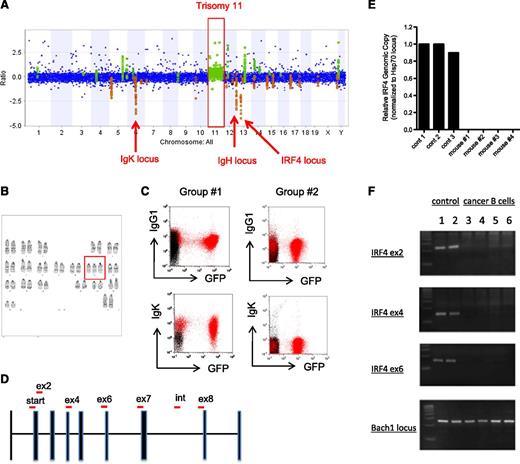 Figure 6. Deletion of IRF4 in miR-125b cells. (A) Analysis of genetic mutations in cancer B cells through comparative genomic hybridization microarray (aCGH). Genomic DNA harvested from sorted miR-125b–overexpressing GFP+CD19+ cancer B cells was subjected to aCGH analysis. Genomic DNA from normal C57bl/6 mice of the same gender (female) was used as controls. The figure represents the relative amount of genetic content of the cancer sample vs the C57bl/6 control (plotted as ratio in y-axis). A genomic region was considered different between the samples if 3 consecutive probes exhibited different signal intensities in the microarray. Regions highlighted in green and orange indicate genomic areas in which the cancer cells have higher and lower DNA content, respectively. The other aCGH analysis is displayed in supplemental Figure 6A. (B) G-band karyotyping of miR-125b–induced cancer B cells. Trisomy 11 is highlighted in red box. (C) Flow cytometric analysis of cancer B cells. Sorted GFP+CD19+ cells isolated from independent groups of MG-125b mice were transplanted into recipient mice. Upon cancer development, the bone marrow of these mice (highlight in red) was analyzed by flow cytometry. The plot shows the samples within the CD19+ gated population. The sample overlaid in black represents total BMCs harvested from healthy control C57bl/6 mice. Group 1 and group 2 corresponds to the aCGH samples displayed in panel A and supplemental Figure 6A, respectively. (D) IRF4 locus and genotyping primer sequences. IRF4 locus is shown with exons represented as solid bars. “Start,” “ex,” and “int” signifies translation start site, exon, and intron, respectively. The red bars represent the PCR product amplified by the primers used for genotyping in panel E-F and supplemental Figure 6E. (E) Quantitative PCR analysis of IRF4 locus. The relative amount of genomic DNA from miR-125b–induced cancer B cells were quantified by quantitative PCR and normalized to control Hsp70 locus. The control samples are genomic DNA harvested from normal C57bl/6 mice. The PCR amplifies a region spanning the translational start site (denoted as “start” in panel C). (F) Genomic DNA from miR-125b–induced cancer B cells was subjected to genotyping analysis. Exon2 (ex2), exon4 (ex4), and exon6 (ex6) of IRF4 were assessed. Bach1 locus was used as positive control. Samples 3-4 and 5-6 correspond to miR-125b–induced cancer B cells harvested from mice originating from group 1 and group 2 described in Figure 5G, respectively. The agarose gel images of the PCRs are displayed.
