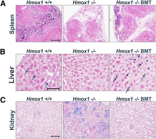 Figure 2. BMT normalizes systemic heme-iron recycling and prevents pathological iron accumulation in kidneys. Perls’ stained cross-sections of paraffin-embedded tissues for nonheme iron. Areas of iron accumulation appear in blue. (A) In the spleen, heme-iron recycling macrophages loaded with iron were found throughout the red pulp of WT Ctr, were absent in untreated in KO Ctr, and were partially restored in KO BMT animals. (B) In the liver, iron-positive Kupffer cells were detected in WT Ctr animals (arrows) and were undetectable in untreated KO BMT animals but were present in large numbers in KO BMT animals (arrows). (C) In the kidneys, WT animals lacked iron accumulations, whereas the kidney KO Ctr animals had abnormal iron accumulations in proximal tubules and glomeruli. The kidneys of KO BMT animals appeared normal, consistent with restoration of normal recycling of Hb by donor macrophages in the liver and spleen. Scale bars represent 100 μm (A,C) and 50 μm (B).