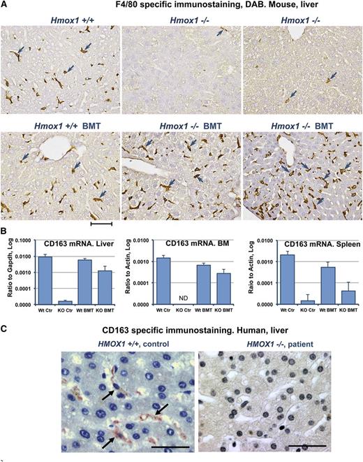 Figure 6. Kupffer cells are absent in the livers of Hmox1−/− animals and a human patient, but BMT restores Kupffer cells to Hmox1−/− mice. (A) Immunohistochemistry for the pan-macrophage marker, F4/80, indicated that Kupffer cells were virtually absent in the livers of Hmox1−/− sham mice (upper middle and right) in comparison with WT mice (left). F4/80-positive cells turned brown after diaminobenzidine staining (arrowheads). BMT completely restored macrophage populations in Hmox1−/− animals (lower middle and right). Results are shown for Hmox1−/− animals that were 4 months (middle) or 1.7 months (right) old at the time the BMT procedure was performed. (B) Expression of the marker of M2 polarized macrophages indicated that CD163 was partially restored in liver, BM, and spleen of KO BMT mice, as determined by quantitative reverse-transcription polymerase chain reaction. ND, not detected. (C) CD163 Kupffer cells normally found in human liver (left) were undetectable in the liver of an HMOX1-deficient patient (right). Scale bars represent 50 μm (A) and 25 μm (C).