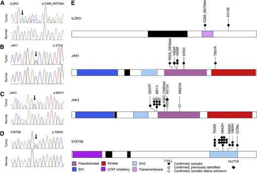 Figure 2. High-frequency IL2RG-JAK1-JAK3-STAT5B mutations in T-PLL. (A-D) Representative IL2RG, JAK1, JAK3, and STAT5B mutations in primary T-PLL cells identified by WGS/WES and confirmed to be somatic by Sanger resequencing of tumor DNA (upper traces) and paired constitutional DNA (lower traces). (E) Schematic representations of mutations in IL2RG, JAK1, JAK3, and STAT5B identified through WGS, WES, or targeted Sanger resequencing of primary T-PLL (circles) and HUT78 cells (diamond). Confirmed somatic mutations are shown as filled symbols; variants where adequate matched constitutional DNA was not available are shown as open symbols. Mutations are clustered in the autoinhibitory pseudokinase domains of JAK1 and JAK3 (purple) or the SH2 domain of STAT5B (light blue) that mediates interactions between JAK and STAT proteins. One additional variant was detected in the kinase domain of JAK1 (red); a single case of T-PLL harbored a somatic 3-amino-acid deletion in the transmembrane domain of IL2RG (purple) as well as a somatic missense mutation in the cytoplasmic domain.
