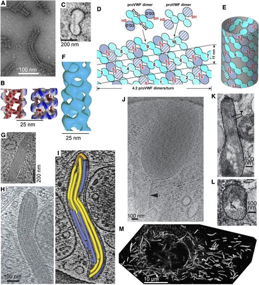 Figure 3. VWF tubule morphogenesis and structure. (A-B) In vitro assembly of D1D2 and (D′D3)2 fragments at pH 6.2 in Ca2+ into tubules (A) and helical 3-dimensional reconstruction (B) showing external view (right) and a cross-section through the hollow tubule (left) colored from red to blue based on distance from the helical axis.6 (C) Single tubule in a clathrin-coated immature WPB in the juxta-Golgi.110 (D-E) Schematic of tubule assembly.6 Helical assembly is shown as progressing from bottom to top. Each successive pro-VWF dimer is numbered and shown alternately with solid or striped diagonal fill. Interdimer disulfide crosslinks form at the twofold symmetry axis between D′D3 domains (red SS). VWF helices are 1-start, that is, contain a single VWF molecule. Because of twofold symmetry, the 2 ends of the helix are identical.6 (F) Helical reconstruction from cryoelectron tomography of tubules in endothelial cell WPB (see panels H-I).19 Panels B and F are aligned vertically to show similar structure of tubules formed in vitro and in vivo. (G) Another example of tubule biogenesis in the juxta-Golgi.110 (H-I) Cryoelectron tomograms of a mature WPB in an endothelial cell (H) and a reconstruction (I) showing individual tubules (colored).19 (J) A WPB with increased spacing between tubules and a stalk (arrowhead).19 The WPB may have been captured during secretion and the stalk may be a secretion pore. (K-L) VWF tubules in porcine platelet α-granules, in EM sections that run parallel (K) or normal (L) to the tubule axis.21 In contrast to WPB, α-granules contain other components that segregate away from the paracrystalline VWF tubules (T, marked with arrows). (M) A cultured human umbilical vein cell immunofluorescently stained with anti-VWF to visualize WPB. Reprinted from Tom Carter, National Institute of Medical Research, United Kingdom, with permission.