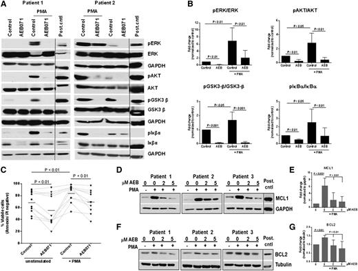 Figure 3. AEB071 antagonizes PMA-induced B-CLL survival and enhances apoptosis. (A-B) CD19+ cells from CLL patients (N = 7) were treated with AEB071 (2 μM) and stimulated with PMA (250 ng/mL) for 24 hours. ERK phosphorylation at Thr202/Tyr204, AKT phosphorylation at Ser473, GSK3-β phosphorylation at Ser9, and IκBα phosphorylation was assessed by immunoblot. Results from 2 patients are presented; black line indicates cropped regions wherein only relevant bands are shown. Band quantification is represented as fold change from unstimulated control (mean ± SD). (C) CD19+ cells from CLL patients (N = 10) were stimulated with PMA (250 ng/mL) in presence or absence of AEB071 (2 μM) for 24 hours and cytotoxicity was measured by annexin/PI staining. Dark lines represent averages. (D-G) CD19+ cells from CLL patients (N = 6) were treated with AEB071 (2 or 5 μM) and stimulated with PMA (250 ng/mL) for 24 hours. Expression of MCL1 (D-E) and BCL2 (F-G) was assessed by immunoblot. Results from 3 patients are presented; black line indicates cropped regions wherein only relevant bands are shown. Band quantification is represented as fold change from unstimulated control (mean ± SD).