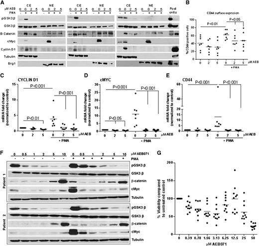 Figure 6. AEB071 targets β-catenin and its downstream transcriptional targets in B-CLL. (A) CD19+ cells from CLL patients (N = 3) were treated with AEB071 (2 or 5 μM) and stimulated with PMA (250 ng/mL) for 24 hours. GSK3-β phosphorylation at Ser9 and protein expression of β-Catenin, c-Myc, and Cyclin D1 was assessed in cytoplasmic (CE) and nuclear extracts (NE) by immunoblot. (B-E) CD19+ cells from CLL patients (N = 7) were treated with AEB071 (2 or 5 μM) and stimulated with PMA (250 ng/mL) for 24 hours, wherein surface expression of CD44 (B) was evaluated in viable cells by flow cytometry and transcript levels of Cyclin D1 (C), c-Myc (D), and CD44 (E) was estimated by real-time PCR. Dark lines represent averages. (F) CD19+ cells from CLL patients (N = 3) were treated with increasing concentrations of AEB071 and stimulated with PMA (250 ng/mL) for 24 hours. GSK3-β phosphorylation at Ser9 and protein expression of β-Catenin and c-Myc was assessed in whole-cell lysates by immunoblot. Results from 2 patients are presented. (G) CD19+ cells from CLL patients (N = 10) were incubated with increasing concentrations of AEB071 for 24 hours. Viability was determined by MTS assay and calculated relative to untreated control. Dark lines represent averages.