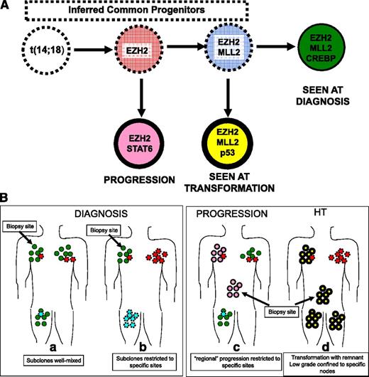 Figure 1. How coupling data from mutation analyses and the complex clonal architecture yields insights in the clinical behavior of FL. (A) The complex clonal architecture of follicular lymphoma. (B) (a) The earliest step in the development of FL is acquisition of the IGH:BCL2 translocation. Cells carrying this lesion are frequently found in healthy individuals. Subsequent but still early steps in development of FL include mutations that disrupt regulation of chromatin structure, including mutations in EZH2 and MLL2. In this hypothetical patient, cells carrying just these mutations were not detected (red and blue cells with dashed borders) but their existence can be inferred from the detection of various cell populations carrying these same mutations as well as additional mutations (green, rose, and yellow cells with solid borders). Later events that are associated with HT include loss (or mutation) of TP53 and CDKN2A (yellow). It appears that in perhaps all cases that are studied with sufficiently sensitive techniques, the population that arises at HT (yellow) is not directly descended from the population detected at the time of diagnosis (green) or at relapse (rose). (b) The complex clonal architecture of FL raises 2 possible scenarios for the distribution of subclones at the time of diagnosis. Either the subclones are well mixed (a) or the subclones are relatively restricted to specific sites (b). For example, there is observational evidence that subclones in the marrow and the nodes are distinct and show only limited mixing in FL. At progression and transformation (c-d), the inhomogeneous distribution of subclones requires that selection of the biopsy site is based on clinical features or PET scan, so that the site of the aggressive subclone is sampled rather than a site composed of a low-grade subclone.
