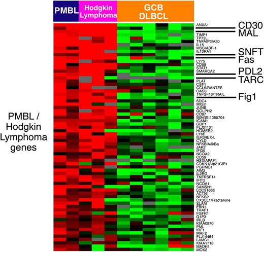 Figure 3. Relationship of PMBL to Hodgkin lymphoma. Relative gene expression is shown in primary PMBLs (average of all biopsy samples), the PMBL cell line K1106, 3 Hodgkin lymphoma cell lines, and 6 GCB DLBCL cell lines. Red represents high gene expression and green low expression. PMBL signature genes that are also expressed at high levels in Hodgkin lymphoma cell lines compared with GCB DLBCL cell lines. (Figure courtesy of Louis Staudt.)