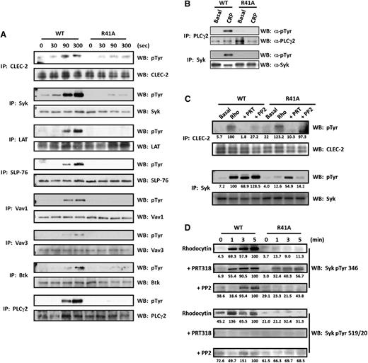Figure 3. SykR41Afl/fl;PF4-Cre signaling is inhibited in response to GPVI and CLEC-2 agonists. WT and SykR41Afl/fl;PF4-Cre platelets (R41A) (5 × 108/mL) were stimulated with either rhodocytin (300 nM for 300 seconds) (A,C) or CRP (3 μg/mL for 90 seconds) (B) followed by lysis. Where stated, platelets were preincubated with either PP2 (20 μM) or PRT318 (5 μM). Proteins were subsequently immunoprecipitated (IP). For the time course (D), platelets were stimulated with rhodocytin (300 nM), and samples were removed after 1, 3, and 5 minutes to prepare whole-cell lysates. Precipitated proteins and whole-cell lysates were then separated by sodium dodecyl sulfate-polyacrylamide gel electrophoresis and western blot (WB) for phosphotyrosine (n = 3). Blots were exposed with either autoradiographic film (A-B) or using a Licor Odyssey FC (C-D). Quantitation was performed with Licor Image Studio and normalized to percentage of the WT/maximal response. Where absent, there was no difference compared with background.