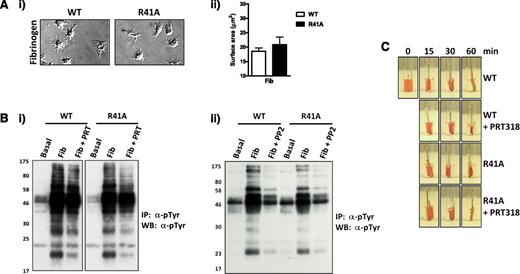 Figure 5. SykR41Afl/fl;PF4-Cre platelets respond normally to integrin αIIbβ3 outside-in signaling. (A) WT and SykR41Afl/fl;PF4-Cre (R41A) platelets (2 × 107/mL) were allowed to spread on coverslips coated with fibrinogen (100 μg/mL) for 45 minutes (n = 3). (B) WT and R41A platelets (5 × 108/mL) were allowed to spread in 6-cm wells coated with fibrinogen (100 μg/mL) for 45 minutes in the presence of PRT318 (5 μM) (i), PP2 (20 μM) (ii), or vehicle. Adherent platelets were then lysed, followed by phosphotyrosine (4G10) immunoprecipitation. Precipitated proteins were separated by sodium dodecyl sulfate-polyacrylamide gel electrophoresis and western blot for phosphotyrosine (n = 3). (C) A clot was initiated in WT and R41A PRP with 10 U/mL thrombin and allowed to retract for 60 minutes (n = 3).