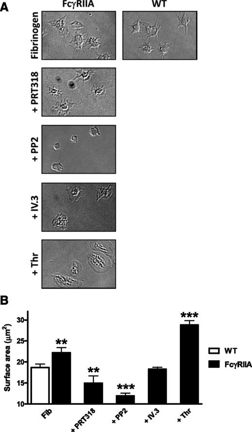 Figure 6. FcγRIIA-mediated spreading is Syk dependent. FcγRIIA transgenic platelets (2 × 107/mL) were allowed to spread on coverslips coated with fibrinogen (100 μg/mL) for 45 minutes in the presence of PP2 (20 μM), PRT318 (5 μM), thrombin (0.1 U/mL), IV.3 fragment antigen-binding fragments (10 μg/mL), or vehicle (n = 3, **P < .01, ***P < .005).