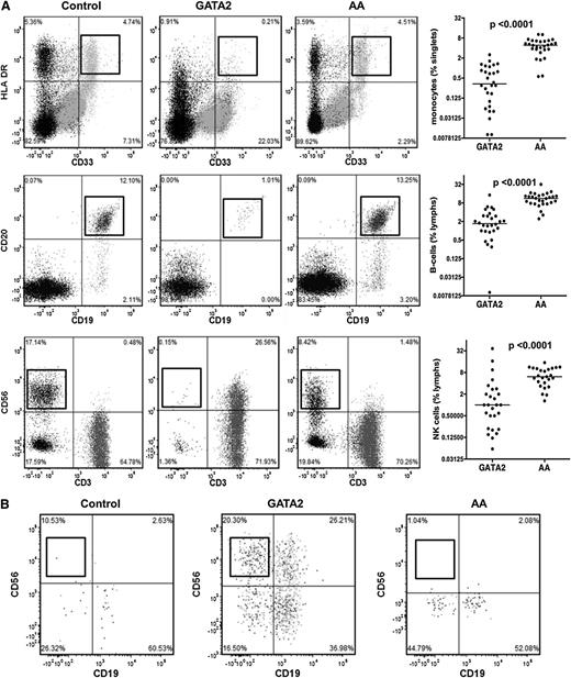 Figure 2. Bone marrow flow cytometric analysis of monocytes and lymphoid subsets in GATA2 and AA patients. (A) GATA2 patients have reduced bone marrow monocytes (CD33+, HLA-DR+), mature B cells (CD19+, CD20+), and NK cells (sCD3−, CD56+) compared with AA patients. (B) A subset of GATA2 patients has atypical CD19−CD56+ plasma cells (gating performed on CD38+, CD138+ positive population), which are not identified in AA patients.