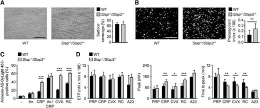 Figure 4. SLAP/SLAP2 deficiency enhances procoagulant activity and (hem)ITAM-dependent thrombin generation in platelets. (A) Unaltered surface coverage by collagen-adherent platelets in WT and Slap−/−/Slap2−/− blood. Representative phase-contrast images are depicted. (B) Increased PS exposure of Slap−/−/Slap2−/− platelets, as demonstrated by Annexin-A5-DyLight 488 staining of platelets. Procoagulant index indicates the ratio of surface coverage of PS-exposing platelets (Annexin-A5-DyLight 488 staining of platelets) to the total surface covered by platelets. Results in (A) and (B) are representative of 2 independent experiments with n ≥ 6. Images were obtained at ×40. Bars represent 50 μm. (C) Washed platelets were stimulated with 0.1 U/mL thrombin, 20 μg/mL CRP, a combination of both thrombin and CRP, 1 μg/mL convulxin, or 0.12 μg/mL rhodocytin, stained with saturating amounts of Annexin-A5-DyLight 488, and directly analyzed by flow cytometry. Results are representative of 2 independent experiments with n = 5. (D) Citrate-anticoagulated PRP was left unstimulated, or platelets were activated by incubation with convulxin (1 μg/mL), CRP (20 μg/mL), rhodocytin (1 μg/mL), or the Ca2+ ionophore A23187 (A23) (10 μM) for 10 minutes at 37°C. Thrombin generation was triggered with tissue factor/CaCl2. Endogenous thrombin potential (left); quantification of thrombin peak height (middle); and quantification of time to peak (right). n = 3 for A23187; n = 7 for CRP and RC; and n = 10 for PRP and CVX. *P < .05; **P < .01; ***P < .001. A23, A23187; CRP, collagen-related peptide; CVX, convulxin; ETP, endogenous thrombin potential; PRP, platelet-rich plasma; RC, rhodocytin; thr., thrombin.