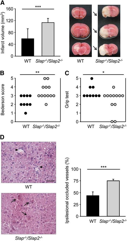 Figure 6. SLAP/SLAP2 deficiency dramatically aggravates neurologic damage after focal cerebral ischemia. Infarct volumes (A) and functional outcome (B-C) 24 hours after focal cerebral ischemia in WT and Slap−/−/Slap2−/− mice were investigated in a murine model of ischemic stroke. Mice were subjected to 30 minutes of tMCAO. (A) Brain infarct volumes in WT (n = 9) and Slap−/−/Slap2−/− (n = 12) mice were measured by planimetry (left). Results represent mean ± SD. Representative images of 3 coronal brain sections stained with 2,3,5-triphenyltetrazolium chloride for 24 hours after 30 minutes of tMCAO (right). Arrows indicate infarcted areas in Slap−/−/Slap2−/− mice. Bederson score (B) and grip test (C) were determined 24 hours after tMCAO. Each symbol represents 1 animal. (D) SLAP/SLAP2 deficiency dramatically increases microvascular thrombosis after 30 minutes of tMCAO. Representative hematoxylin and eosin stains from the ipsilesional hemispheres of WT (n = 6) and Slap−/−/Slap2−/− (n = 8) mice (left), and determination of the percentage of occluded vessels (right). Number of thrombotic vessels was significantly increased in Slap−/−/Slap2−/− mice (arrows), whereas the microvascular patency was largely preserved in WT mice (arrowheads). Images were obtained at ×40. Bar represents 50 μm. *P < .05; **P < .01; ***P < .001.