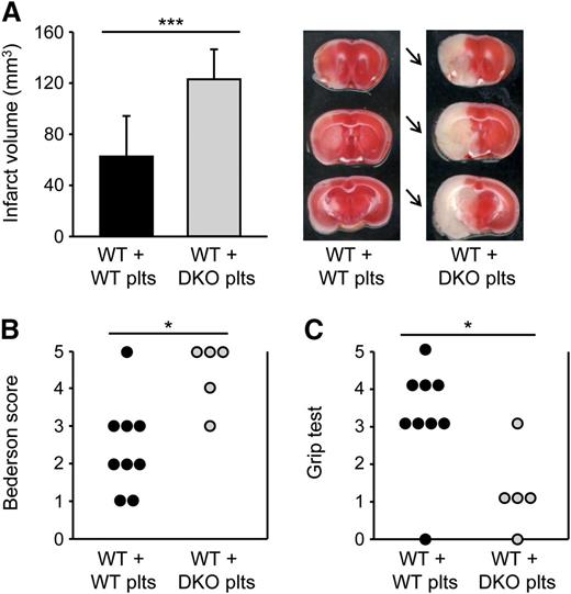Figure 7. SLAP/SLAP2 deficiency in platelets induces a dramatic increase in infarct volume in a model of ischemic stroke. Infarct volumes (A) and functional outcome (B-C) 24 hours after focal cerebral ischemia in WT mice reconstituted with WT or Slap−/−/Slap2−/− (DKO) platelets after depletion of endogenous platelets were investigated in a murine model of ischemic stroke. Mice were subjected to 30 minutes of tMCAO. (A) Brain infarct volumes in platelet-depleted WT mice transfused with WT (n = 12) or Slap−/−/Slap2−/− (n = 8) platelets were measured by planimetry (left). Results represent mean ± SD. Representative images of 3 coronal brain sections stained with 2,3,5-triphenyltetrazolium chloride for 24 hours after 30 minutes of tMCAO (right). Arrows indicate infarcted areas in WT mice recipients of Slap−/−/Slap2−/− platelets. Bederson score (B) and grip test (C) were determined 24 hours after tMCAO. Each symbol represents 1 animal. *P < .05; ***P < .001. DKO, double knockout; plts, platelets.