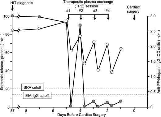 Figure 1. Serial SRA and IgG-specific anti-PF4/heparin EIA test results in relation to 4 therapeutic plasma exchange (TPE) sessions performed on 4 consecutive days (last TPE performed 2 days before cardiac surgery using heparin). Heparin rechallenge during cardiac surgery did not result in increased levels of anti-PF4/heparin antibodies during the postoperative period (testing until postoperative day 7) (not shown). Although at the time of initial HIT diagnosis, the patient also had detectable anti-PF4/heparin antibodies of IgA class (EIA-IgA = 1.20 OD U; normal <0.45 U) and IgM class (EIA-IgM = 0.46 U; normal <0.45 U), both the IgA and IgM EIAs were negative 3 months later pre-TPE (0.30 and 0.34 OD U, respectively). EIA-IgG, enzyme-immunoassay (IgG-specific); OD, optical density; SRA, serotonin-release assay.