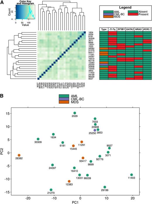 Figure 4. GEP analysis. (A) Clustering of GEPs using the Euclidean distance metric and hierarchical clustering. The adjacent table details the acquired mutation of the clustered malignancies. (B) Principle component analysis performed on the GEPs of 24 inv(3)/t(3;3) myeloid malignancies displays no discrimination between AML and MDS.