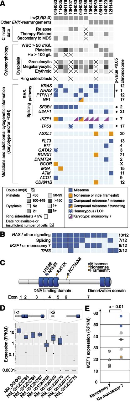 Figure 1. Mutations in EVI-r AMLs. (A) Clinical, morphologic, cytogenetic, and mutational data in EVI1-r AML samples. LOH, loss of heterozygosity. (B) Summary of commonly mutated pathways. (C) IKZF1 protein and mutations. Four N-terminal (DNA-binding domain) and 2 C-terminal (dimerization domain) zinc fingers are represented by blue cylinders. (D) Distribution of IKZF1 isoforms in EVI1-r samples. The only sample expressing isoform NM_001220772 (Ik6) harbors compound heterozygous mutations of IKZF1. (E) IKZF1 expression levels in EVI1-r AMLs with and without monosomy 7. Blue dots represent samples with IKZF1 N159S mutation; orange dot indicates IKZF1 frameshift mutation. Analysis is performed with all 12 specimens except for D, where n = 9.