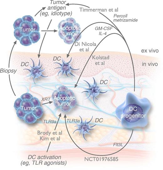These similar approaches of bringing together DCs and tumor antigens have been tested clinically. Each approach differs in the site and technique of isolating, loading, and activating DCs, by either ex vivo Percoll and metrizamide gradient separation with ex vivo Id pulsing4; ex vivo monocyte culture in GM-CSF/IL-4 with ex vivo apoptotic tumor pulsing5; in vivo (scarce) DCs and (abundant) tumor B-cell TLR activation with in vivo tumor irradiation7; ex vivo monocyte culture in GM-CSF/IL-4 with in vivo tumor irradiation, GM-CSF, and rituximab1; or in vivo Flt3L-mobilized DCs with in vivo tumor irradiation and TLR activation. NCT01976585 refers to the trial registry number (clinicaltrials.gov) of a clinical trial currently in progress. Flt3L, FMS-related tyrosine kinase 3 ligand. Professional illustration by Luk Cox, Somersault 18:24.