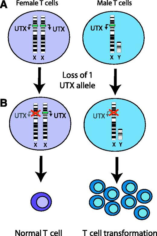 UTX is an X-linked tumor suppressor in T-cell leukemogenesis. (A) The UTX demethylase is within the nonautosomal region of chromosome X. Importantly, expression of this gene escapes X inactivation, and both alleles are expressed in female cells. (B) Following mutational inactivation of 1 UTX allele, female cells continue to express the wild-type allele, which appears to be sufficient for tumor suppression. By contrast, loss of the only UTX allele in male cells results in complete inactivation of this tumor suppressor, which promotes T-cell transformation.