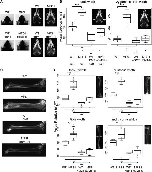 Figure 3. nBMT prevents bone defects in MPS I mice. (A) Skull morphology (on the left) and radiographs (on the right) of 37-week-old WT, MPS I, WT nBMT, and MPS I nBMT-hi mice. Signs of skull abnormalities include blunted snouts with a loss of the fine taper to the face. (B) Measurements of maximum skull width and zygomatic arch width. All measures were performed on radiographic images of WT (n = 8; 4 males and 4 females), MPS I (n = 8; 4 males and 4 females), WT nBMT (n = 8; 5 males and 3 females), and MPS I nBMT-hi mice (n = 7; 4 males and 3 females), as shown on the right side of each chart. The median values relative to WT mice and minimum/maximum values are shown. *P < .05; **P < .01; ***P < .001 with Wilcoxon nonparametric unpaired test, 2 sides. (C) Representative examples of femur radiographs of WT, MPS I, WT nBMT, and MPS I nBMT-hi mice. (D) Measurements of femur, humerus, tibia, and radius-ulna thicknesses. The pictures on the right side of each graph indicate how measures were calculated. The median values relative to WT mice and minimum/maximum values are shown. *P < .05; **P < .01; ***P < .001 with Wilcoxon nonparametric unpaired test, 2 sides.