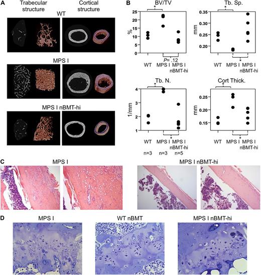 Figure 5. nBMT enhances cortical and trabecular bone architecture in MPS I mice. Micro-CT evaluation of femurs from 37-week-old male WT (n = 3), MPS I (n = 3), and MPS I nBMT-hi (n = 5) mice. (A) Representative 2D and 3D reconstructed images of trabecular bone and of midshaft cortical bone (transaxial section). (B) Bone mineral volume (BV/TV), trabecular separation (Tb. Sp.), trabecular number (Tb. N.), and cortical bone thickness (Cort. Thick.) were measured using Skyscan CT-analyzer software and the data presented as dot plot. *P < .05 with Wilcoxon nonparametric unpaired test, 1 side. (C) Representative pictures of the femur cortical bones of MPS I and MPS I nBMT-hi mice (hematoxylin and eosin staining), as indicated. The inner surface of the cortex is on the left. Magnifications, ×20 and ×40. (D) Representative pictures of the proximal tibia and distal femoral growth plate of MPS I, WT nBMT, and MPS I nBMT-hi mice (Toluidine blue stain, ×40).