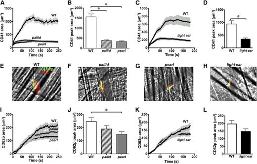 Figure 3. Impaired thrombus formation and α granule secretion after laser injury in HPS model mice. WT, pallid, pearl, or light ear mice were injected with fluorophore-conjugated antibodies to CD41 (to detect total platelets) and to P-selectin (to detect α granule secretion) and then subjected to laser-induced injury in the cremaster muscle microvasculature. Accumulation of signal for CD41 and P-selectin at injury sites was imaged by live intravital video microscopy. The total area of CD41+ (A-D) and P-selectin+ (I-L) platelet accumulation at injury sites was quantified over time. The time course in separate sets of experiments is shown for WT vs pallid and pearl mice for 4 minutes (A and I) or WT vs light ear mice for 3 minutes (C and K). Panels B,D,J,L show the peak area of accumulation at the end of the time course (mean ± standard deviation from at least 3 independent experiments). (E-H) Frames from movies at the 3-minute time point of representative thrombi labeled for P-selectin (green) and CD41 (red) in WT, pallid, pearl, and light ear mice (red and green overlay is yellow). *P < .05.