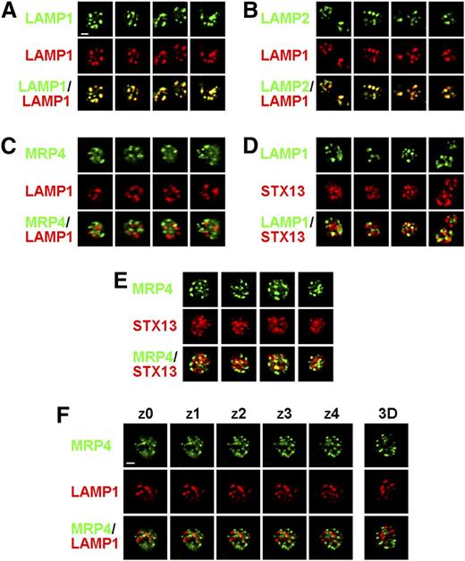 Figure 4. LAMP1 and LAMP2 do not localize predominantly to dense granules in platelets. Platelets from WT mice were fixed, permeabilized, and labeled with a rabbit antibody to the LAMP1 cytoplasmic domain together with rat monoclonal antibodies to LAMP1 (A), LAMP2 (B), or multidrug resistance protein 4 (MRP4) (C and F), or with a rabbit antibody to syntaxin 13 (STX13) and rat monoclonal antibodies to LAMP1 (D) or MRP4 (E) and fluorophore-conjugated secondary antibodies. Platelets were then analyzed by deconvolution immunofluorescence microscopy. Shown are 4 single-plane images of 1 or 2 platelets each labeled by each antibody combination. (F) Shown are 5 sequential z planes (separated by 0.2 μm) and a 3-dimensional (3D)-rendered model of a single platelet labeled for LAMP1 and MRP4. Bar represents 1 μm.