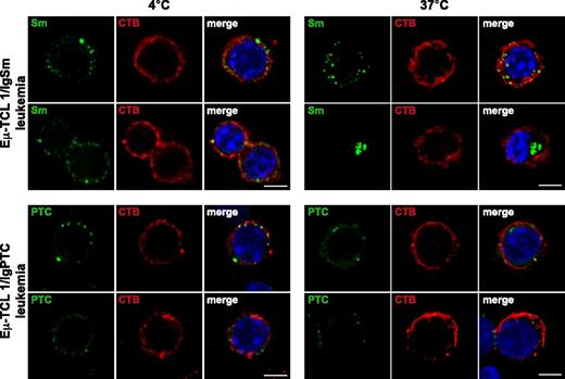 Figure 6. Internalization of Sm and PtC by primary leukemic cells. Eμ-TCL1/IgSm leukemia cells were stained at 4°C with biotin-labeled Sm, washed, and then stained with streptavidin-FITC. Eμ-TCL1/IgPtC leukemia cells were stained at 4°C with fluorescein-labeled PtC-liposomes. Cells were then incubated for 20 minutes at 4°C or 37°C, fixed, and costained with cholera toxin B (CTB)-Alexa 633 to identify the cellular membranes and Hoechst 33332 to mark the nuclei. Images were acquired with a laser scanning confocal microscope (TCS SP5; Leica Microsystems, Mannheim, Germany) using a ×40 (NA = 1.25) oil immersion lens with optical pinhole at 1 AU. Confocal Z-stacks collected at a magnification of ×40 with a 0.29-μm interval and a 5-μm total optical depth are displayed. Scale bar indicates 5 μm. Images at 4°C show Sm/CTB and PtC/CTB colocalization on the cellular membrane. In images acquired from cells incubated at 37°C, Sm and PtC can be seen dissociated from CTB and located below the cellular membrane. IgHEL-expressing normal B cells incubated either with the Sm antigen or PtC were used as a negative control in these experiments (data not shown).