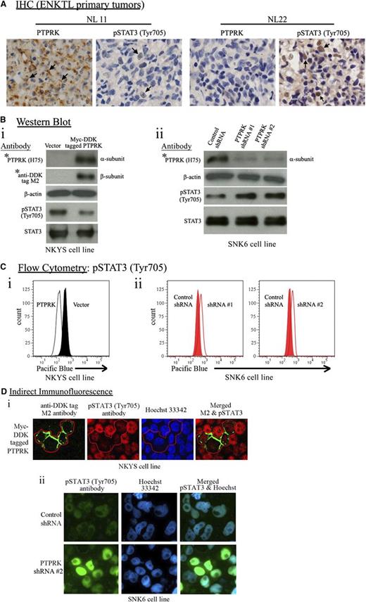 Figure 2. PTPRK protein expression inversely correlates with STAT3 activation. (A) Immunohistochemical staining of paraffin sections of representative NKTCL primary tumors with high (NL11) and low (NL22) PTPRK expression using a rabbit polyclonal PTPRK (H75) antibody raised against amino acids 27-101 mapping within an N-terminal extracellular domain of human PTPRK (brown cellular membranous staining between the cell-cell contact and faint cytoplasmic staining is indicated by arrows), and a phospho-STAT3Tyr705 antibody (brown nuclear staining is indicated by arrows). The immunostaining demonstrated that PTPRK protein expression inversely correlated with phospho-STAT3Tyr705 levels in NKTCL primary tumors. Original magnification ×400. (B) Western blot analyses of PTPRK and phospho-STAT3Tyr705 expression in PTPRK nonexpressing NKYS cells with reconstitution of PTPRK expression (i) and in PTPRK-expressing SNK6 cells with partial knockdown of PTPRK expression (ii), using the indicated antibodies. Restoration of PTPRK expression significantly decreased phospho-STAT3Tyr705 levels in NKYS cells, whereas partial knockdown of PTPRK significantly increased phospho-STAT3Tyr705 levels in SNK6 cells. (Top of 2Bi) The blot was probed first with a PTPRK antibody and was then stripped and reprobed with the anti-DDK tag M2 antibody to detect the PTPRK-tag fusion protein. β-Actin was used as an internal loading control. The levels of STAT3/phospho-STAT3Tyr705 proteins were analyzed using STAT3 and phospho-STAT3Tyr705 antibodies. The entire western blot images showing precursor and mature subunits of PTPRK are presented in supplemental Figures 2A,3. (C) Flow cytometry analyses on (i) PTPRK-transduced (white) vs mock vector-transduced (black) NKYS cells, and (ii) PTPRK-specific shRNA-treated (white) vs control shRNA-treated (red) SNK6 cells using a phospho-STAT3Tyr705 antibody. (D) (i) PTPRK nonexpressing NKYS cells were infected with a retrovirus expressing PTPRK with a myc-DDK tag at the 3′ end. Double indirect immunofluorescence was performed to detect ectopic PTPRK (detected using an anti-DDK tag M2 antibody, and green fluorescence cellular membranous and cytoplasmic staining) and phospho-STAT3Tyr705 proteins (red fluorescence nuclear staining). Hoechst 33342 was used to stain the nuclei (blue fluorescence nuclear staining). The images were captured using a Carl Zeiss LSM 510 confocal microscope (original magnification ×600). (ii) PTPRK-expressing SNK6 cells were infected with lentivirus expressing PTPRK-targeting shRNA. Indirect immunofluorescence was performed to detect phospho-STAT3Tyr705 protein (green fluorescence nuclear staining). Hoechst 33342 was used to stain the nuclei. The image was captured using a Leica Q550CW microscope (original magnification ×400).