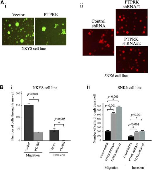 Figure 6. PTPRK inhibits the cell migration and invasion ability of NKTCL cells. (A) Images show cell-cell interactions of NKTCL cells after resuspension in fresh medium for 6 hours. (i) Clumps of 5 to 10 cells were formed by GFP-sorted PTPRK-transduced NKYS cells in culture (diffused green fluorescence over the entire cell). Mock vector-transduced NKYS cells were used as the control. (ii) Clumps of 5 to 10 cells were only formed by RFP-sorted control shRNA-transduced SNK6 cells in culture (diffused red fluorescence over the entire cell), but not cells transduced with PTPRK-specific shRNA#1 and shRNA#2. Original magnification ×400. (B) Bar charts show the migration and invasion rate of NKTCL cells according to the number of sorted cells that passed through transwell inserts containing 8-µm pore polyethylene terephthalate membranes and the number of cells that passed through inserts covered with diluted Matrigel basement membrane, respectively. The cells that migrated to the lower chambers were counted in 5 randomly selected microscopic fields (200×). Each assay was repeated 3 times. The bars indicate the mean ± SE. Re-expression of PTPRK significantly inhibited the cell migratory and invasion abilities of non–PTPRK-expressing NKYS cells (i), whereas knockdown of PTPRK enhanced SNK6 cell migration and invasion (ii).