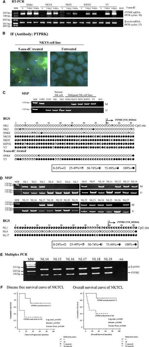 Figure 7. Underexpression of PTPRK mRNA is due to promoter hypermethylation and monoallelic deletions in NKTCL. (A) Gel images showing the PTPRK mRNA expression levels detected by semiquantitative RT-PCR in 5 NKTCL cell lines after treatment with 5-aza-dC for 3 or 6 days. Pharmacologic demethylation with 5-aza-dC restored PTPRK mRNA expression in all 4 non–PTPRK-expressing NKTCL cell lines. The mRNA expression in each sample was normalized to β-actin expression. (B) Immunofluorescence image of a non–PTPRK-expressing NKYS cell line showing the re-expression of PTPRK protein after treatment with the 5-aza-dC demethylating agent; an antibody to the N-terminus of PTPRK was used (arrows indicate green fluorescent cellular membranous and cytoplasmic staining). Original magnification ×1000. (C) (Top) Gel image revealing the methylation status of the PTPRK promoter, as determined by MSP in 2 preparations of normal NK cells and 5 NKTCL cell lines. The PTPRK promoter was unmethylated in PTPRK-expressing normal NK cells and NK malignant cell lines, whereas PTPRK was methylated in non–PTPRK-expressing NKTCL cell lines. (Bottom) Detailed methylation analysis of the CpG sites in the PTPRK promoter was performed via BGS in normal NK cells, untreated NKTCL cells, and 5-aza-dC–treated malignant cells. BGS confirmed the PTPRK promoter methylation status determined by MSP. The amount that each circle is filled represents the percentage of methylated cytosines detected via BGS from 8 to 10 sequenced colonies. (D) The PTPRK promoter was frequently methylated in NKTCL primary tumors. (Top) The composite gel images show the PTPRK promoter methylation status as determined by MSP in 27 NKTCL primary tumors. BGS confirmed the PTPRK promoter methylation status determined by MSP (bottom). The CpG sites of each representative case are presented in the row as individual circles. (E) Gel image of PTPRK gene allelic loss analysis in 6 representative cases of primary NKTCL tumors as determined by semiquantitative multiplex PCR (30 cycles) using the β-globin gene as normal allele control. Samples with a PTPRK/β-globin allelic ratio of < 0.75, as determined by densitometry, were considered to have a monoallelic PTPRK gene deletion (case #14, case #15, and case #16). (F) Methylation of the PTPRK promoter significantly correlated with inferior OS in NKTCL patients treated with the SMILE protocol. Kaplan-Meier curves indicating DFS (left panel) and OS (right panel) distributions according to methylation status of the PTPRK promoter in NKTCL patients. Both Kaplan-Meier curves were compared using the log-rank, Breslow, and Tarone-Ware tests, and the P values are presented alongside the survival plots. The results revealed that methylation of the PTPRK promoter was significantly correlated with inferior DFS and OS in NKTCL patients treated with the SMILE regimen. The treatment outcome data were available for the 17 NKTCL patients treated with the SMILE regimen who were included in this study. M, methylated; MW, molecular weight markers; U, unmethylated; UMD, universal methylated DNA; UUD, universal unmethylated DNA.