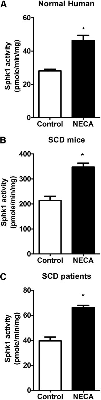 Figure 2. Adenosine directly increases erythrocyte SphK1 activity. SphK1 activity in cultured primary erythrocytes from (A) normal human subjects, (B) SCD transgenic mice, and (C) SCD patients after NECA (10 μM) treatment of 30 min. Values shown represent the mean ± SEM (n = 5 for SCD patients and normal human subjects; n = 6 for SCD transgenic mice and WT mice). *P < .05 NECA vs control.