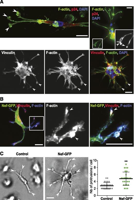 Figure 4. HIV-1–infected and Nef-expressing cells form cell protrusions in Matrigel defined as 3D podosomes. (A-B) Confocal images of (A) HIV-1–infected and (B) NefSF2-expressing cells migrating inside Matrigel. (A) (Upper) HIV-1 p24 (red), F-actin (green), and 4,6 diamidino-2-phenylindole (blue); inset is ×2 zoom. (Lower) Vinculin (red), F-actin (green), and 4,6 diamidino-2-phenylindole (blue). (B) Nef (green), F-actin (blue), and vinculin (red). Inset, ×3.5 zoom. Arrowheads: 3D podosomes. (C) Brightfield images of control and NefSF2-expressing macrophages inside Matrigel and quantification of the number of protrusions per cell. Mean ± SD, n = 4 (>20 cells per condition per donor). Arrowheads: 3D protrusions. Scale bars, 10 μm.