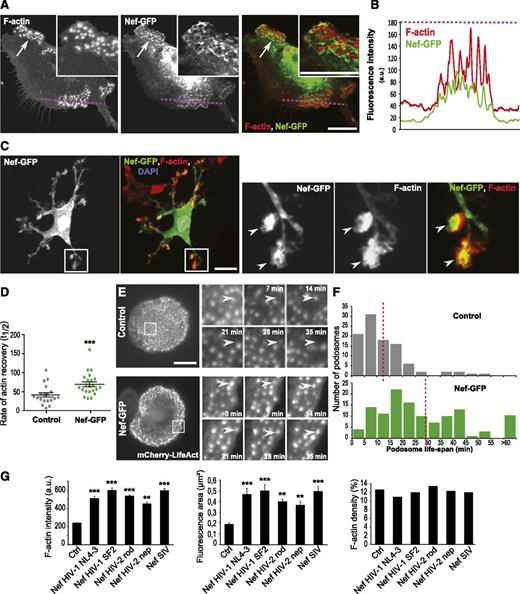 Figure 5. Nef stabilizes podosomes and increases the size of the F-actin core. (A) Confocal images of NefNL4-3-expressing hMDMs on glass. Inset, 2× zoom; arrow, large podosomes where NefNL4-3 localizes. (B) Normalized fluorescence intensity profiles of F-actin and NefNL4-3 along the pink dotted line in A. (C) Confocal images of hMDMs expressing NefSF2-GFP inside Matrigel. Inset, 3.5× zoom; arrowheads, colocalization of NefSF2 with F-actin at 3D podosomes. (D) FRAP analyses in hMDMs cotransfected with mRFP-β-actin, and NefNL4-3-GFP or GFP (control). Mean ± SEM, representative of 6 independent experiments (donors) (>20 podosomes per condition for each donor). (E-F) Time-lapse analysis of podosomes. hMDMs were cotransfected with LifeAct-mCherry (F-actin) and NefNL4-3-GFP or GFP. (E) Images from supplemental Videos 2 and 3. (F) Quantification of podosome life span. n = 4 (>100 podosomes per condition). Red dotted lines: median. (G) Automatic quantification of F-actin intensity, fluorescence area, and F-actin density inside podosomes in hMDMs expressing the indicated Nef mutants. Nef from different strains were used: 2 HIV-1 (NL4-3 and SF2), 2 HIV-2 (rod and nep from Nepal84), and 1 SIV. Mean ± SEM, n = 3 (>1000 podosomes from ≥10 cells per donor). Scale bars, 10 μm.
