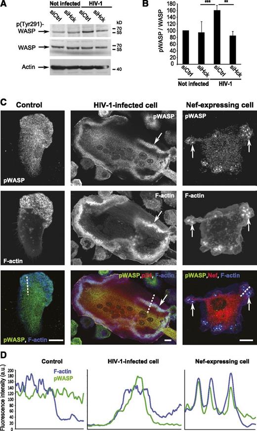Figure 7. HIV-1 infection of human macrophages increases phosphorylation of WASP by Hck at podosomes. (A) hMDM whole-cell lysates western blot using antibodies against phosphoTyr291-WASP, WASP, and actin. (B) Quantification of the phosphoTyr291-WASP on total WASP ratio. Mean ± SD, n = 6. (C) Confocal images of hMDMs on glass. Phospho-WASP (green), p24, or Nef (red) and F-actin (blue). Arrows: accumulation of phospho-WASP at podosomes. Scale bars, 10 μm. (D) Normalized fluorescence intensity profiles of F-actin and phospho-WASP along the dotted lines in C.