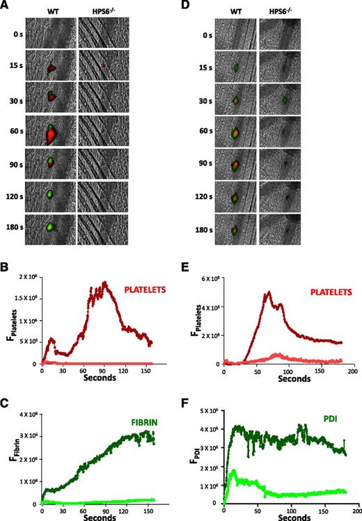 Figure 1. Platelet thrombus formation, fibrin generation, and PDI secretion after laser-induced arteriolar wall injury in HPS6−/− and WT mice. Platelet-specific anti-CD42b antibody and fibrin-specific mouse anti-human fibrin monoclonal antibody were infused into mice, and the cremaster arteriole subjected to laser injury and the induction of thrombus formation. (A) Representative images of the fluorescence associated with fibrin (green) and platelets (red) over 180 seconds after laser-induced vessel wall injury. (B) Median integrated platelet fluorescence intensity vs time in WT mice (dark red) and HPS6−/− mice (red). (C) Median integrated fibrin fluorescence intensity vs time in WT mice (dark green) and HPS6−/− mice (green). Data are from 30 thrombi in 3 mice for HPS6−/− and WT mice. In panels A-C, platelet-specific anti-CD42b antibody and nonblocking polyclonal anti-PDI antibody were infused into mice to detect platelets and PDI during thrombus formation. (D) Representative images of fluorescence associated with PDI (green) and platelets (red) over 180 seconds of thrombus formation after laser-induced vessel wall injury in WT and HPS6−/− mice. (E) Median integrated platelet fluorescence intensity during thrombus formation in WT mice (dark red) and HPS6−/− mice (red). (F) Median integrated PDI fluorescence intensity during thrombus formation in WT mice (dark green) and HPS6−/− mice (green). F, fluorescence intensity.