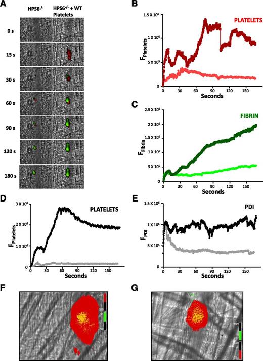 Figure 4. Rescue of thrombus formation in HPS6−/− mice by infusion of WT platelets. Washed platelets isolated from WT mice were infused into HPS6−/− mice to a final approximate concentration of 10% to 20% of the total mouse platelet count. Platelet-specific anti-CD42b antibody and fibrin-specific mouse anti-human fibrin monoclonal antibody were infused to detect platelets and fibrin during in vivo thrombus formation initiated by laser-induced injury. (A) Representative images of the fluorescence associated with fibrin (green) and platelets (red) over 180 seconds after laser-induced vessel wall injury in an HPS6−/− mouse (left) and an HPS6−/− mouse treated with WT mouse platelets (right). (B) Median integrated platelet fluorescence intensity as a function of time in the absence (red) and presence (dark red) of WT platelets. (C) Median integrated fibrin fluorescence intensity as a function of time in the absence (green) and presence (dark green) of WT platelets. Under identical experimental conditions, a nonblocking anti-PDI antibody was employed instead of the fibrin-specific monoclonal antibody to visualize PDI. (D) Median integrated platelet fluorescence intensity as a function of time in the absence (gray) and presence (black) of infused WT platelets. (E) Median integrated PDI fluorescence intensity as a function of time in the absence (gray) and presence (black) of infused WT platelets. Data in panels B-E are from 30 thrombi in 3 mice for each condition. (F) Distribution of calcein-labeled WT donor platelets in a developing thrombus following their infusion into an HPS6−/− mouse. (G) Distribution of calcein-labeled WT donor platelets in a developing thrombus following their infusion into a WT mouse. Donor WT platelets, green; platelets, red; merge, yellow.