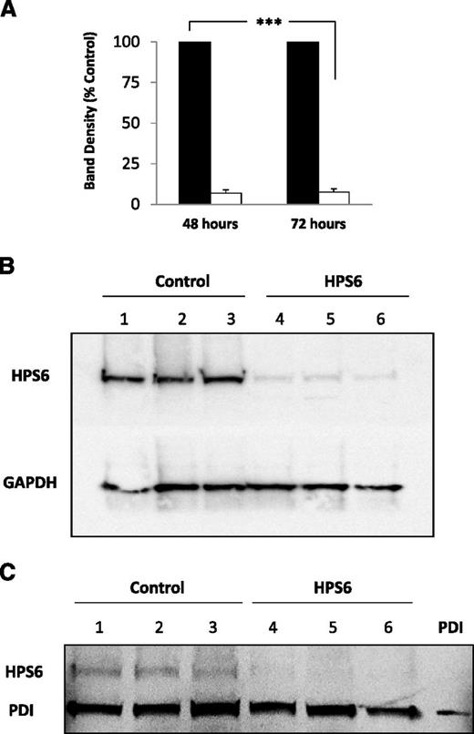 Figure 6. HPS6 knockdown in HUVECs treated with HPS6 siRNA. HPS6 in HUVECs 48 and 72 hours posttransfection with HPS6 or control siRNA were detected by SDS-PAGE of cell lysates followed by immunoblotting with polyclonal anti-HPS6 antibodies (HPS6d; 2.5 μg/mL). (A) Band densities of HPS6 at 48 and 72 hours posttransfection with control siRNA (closed bars) or HPS6 siRNA (open bars). Control is shown as 100%. Data represent mean ± SD (n = 3; ***P < .001). (B) Immunoblot of HPS6 (50 μL of lysate from confluent monolayer, ∼0.25 × 106 cells) 72 hours posttransfection with control siRNA (lanes 1, 2, and 3) or HPS6 siRNA (lanes 4, 5, and 6). The membranes were immunoblotted for GAPDH (polyclonal anti-GAPDH, 1 μg/mL) as a loading control. (C) HPS6 knockdown does not affect PDI storage in HUVECs. PDI and HPS6 in HUVECs 72 hours posttransfection with HPS6 or control siRNA were detected by SDS-PAGE of cell lysates, followed by immunoblotting with polyclonal anti-PDI antibody (DL-11; 1 μg/mL) and polyclonal anti-HPS6 antibody (HPS6d; 2.5 μg/mL), respectively. Immunoblot of PDI and HPS6 (25 μL of lysate from confluent monolayer, ∼0.25 × 106 cells) 72 hours posttransfection. HUVEC lysate from cells treated with control siRNA (lanes 1, 2, and 3) or HPS6 siRNA (lanes 4, 5, and 6). Recombinant PDI (15 ng) was run as positive control. GAPDH, glyceraldehyde-3-phosphate dehydrogenase.