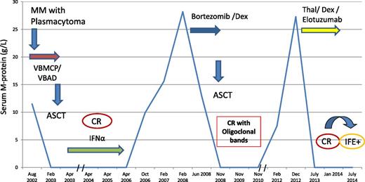 Figure 4. A patient successfully retreated with a second ASCT. Thal/Dex, thalidomide and dexamethasone.